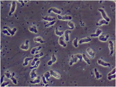 Naegleria fowleri outbreak in Pakistan: unveiling the crisis and path to recovery